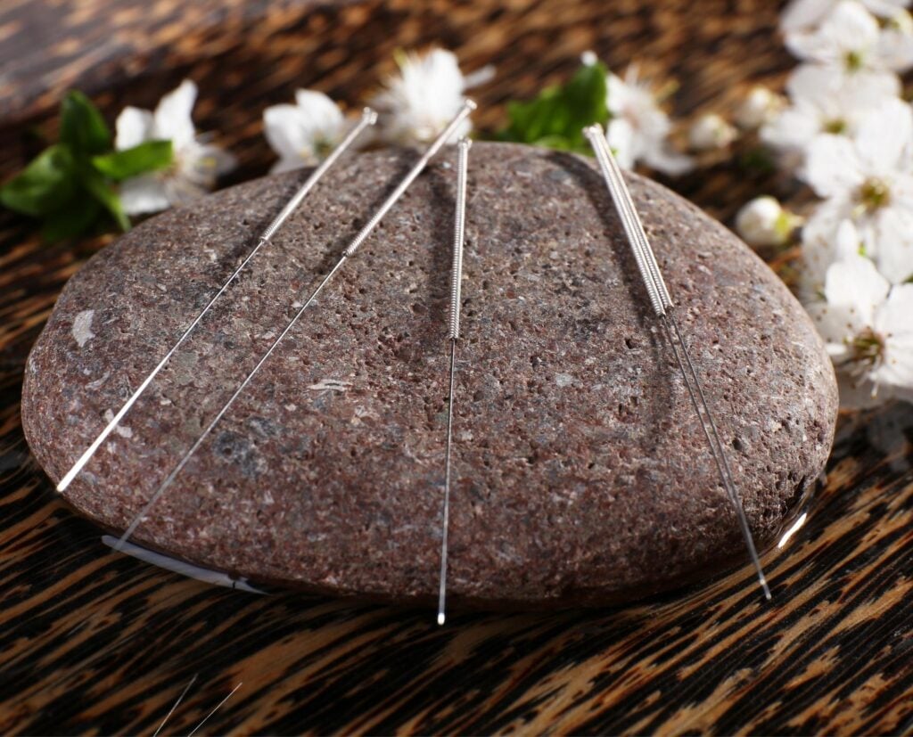 ACUPUNCTURE AND CHINESE HERBS FOR THE BENEFIT OF OAB 1980 × 1000 px