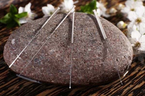 ACUPUNCTURE AND CHINESE HERBS FOR THE BENEFIT OF OAB 1980 × 1000 px