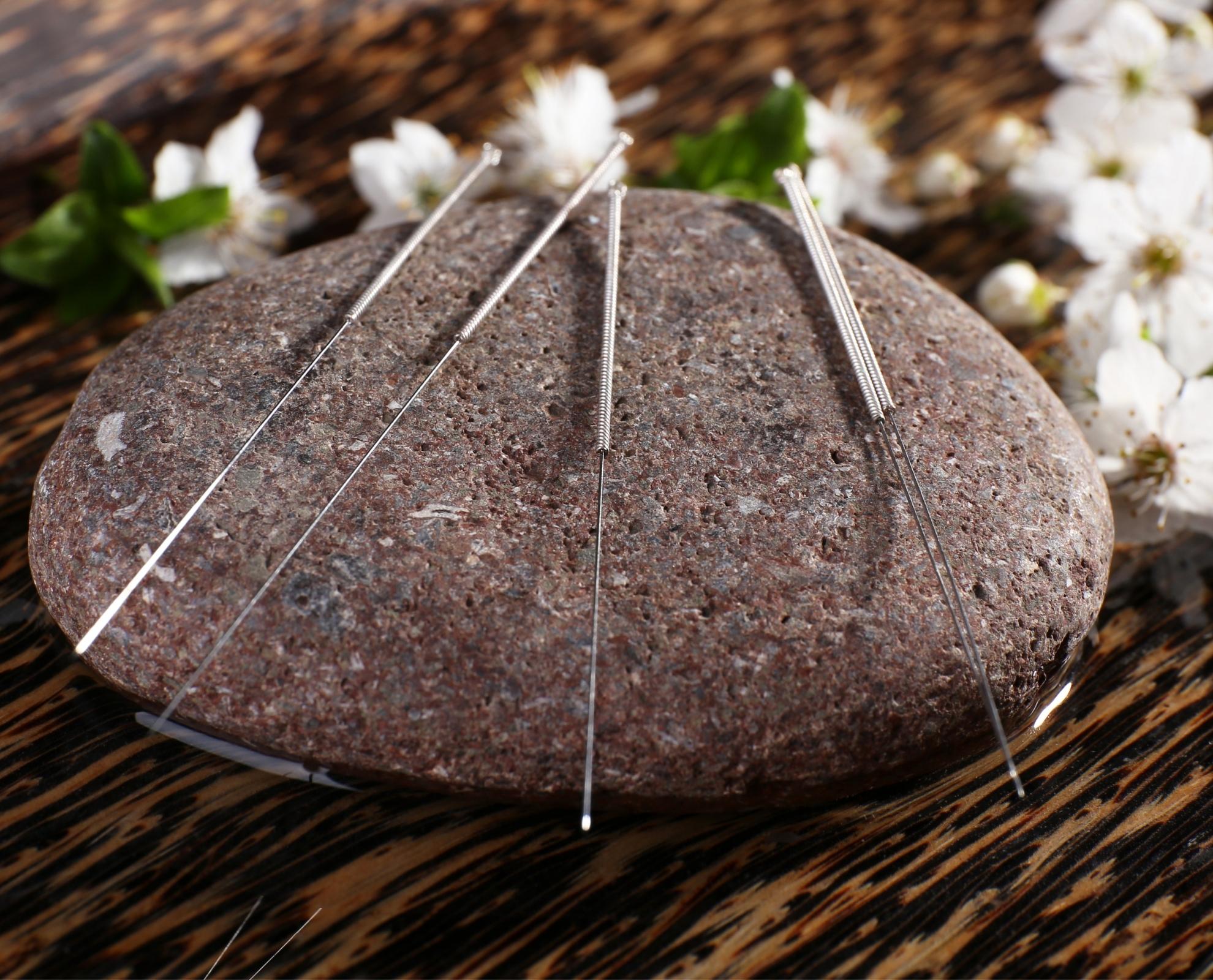 Acupuncture and Chinese Herbs for the Benefit of OAB National Association For Continence