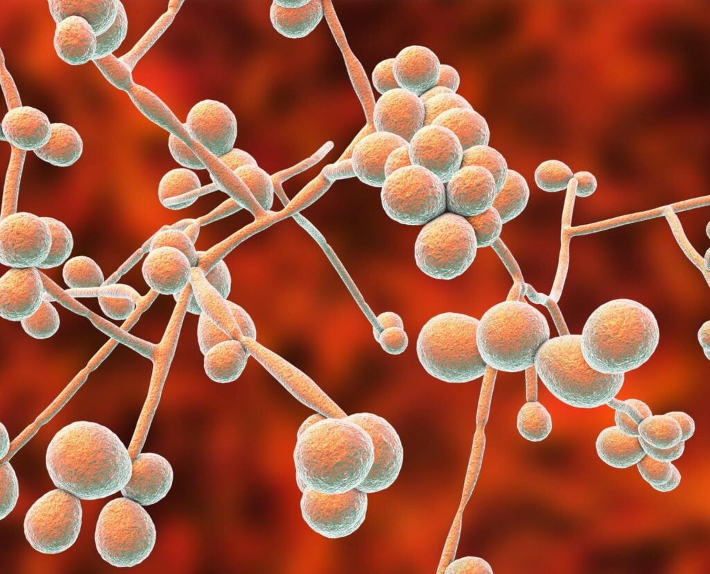 How To Get Rid Of A Yeast Infection 1980 × 1600 px