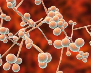 How To Get Rid Of A Yeast Infection 1980 × 1600 px