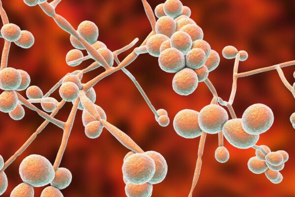 How To Get Rid Of A Yeast Infection 1980 × 1600 px How To Get Rid Of A Yeast Infection 1980 × 1600 px