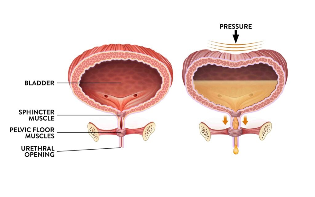 female bladder and pelvic floor