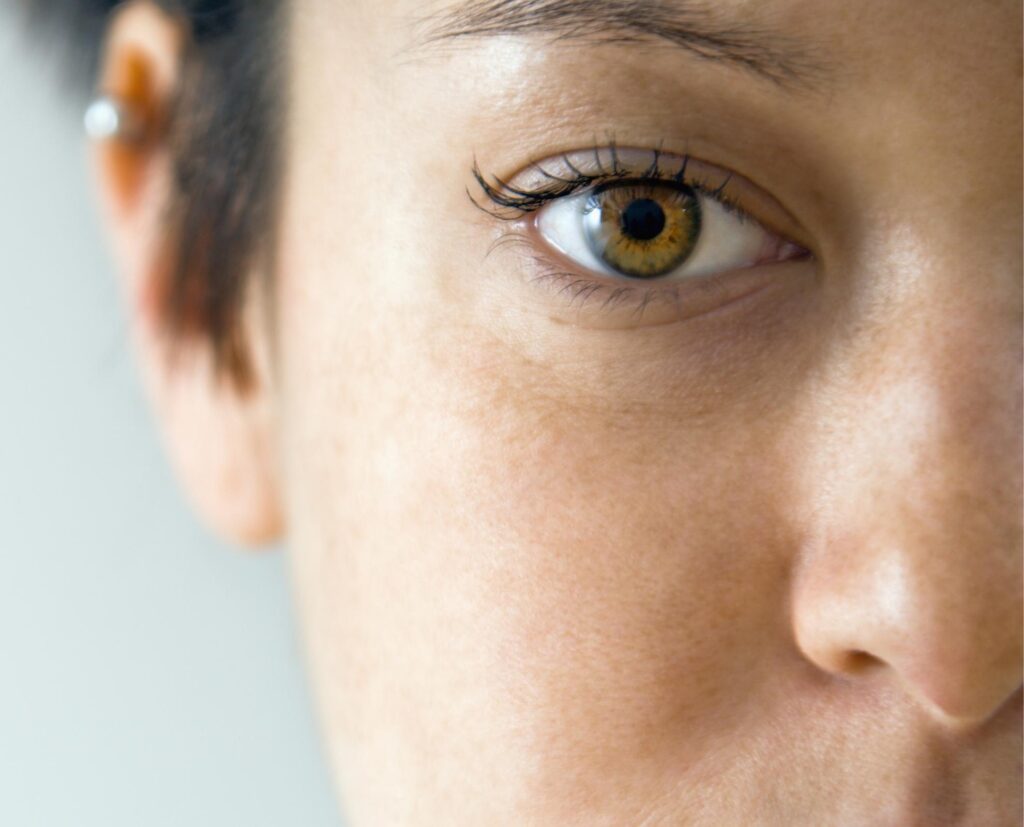 What Is Crohn s Disease