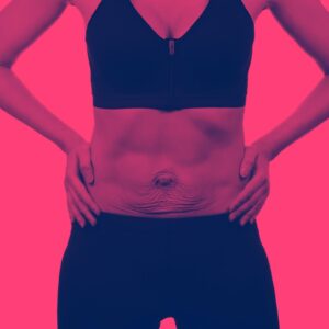 What Is Diastasis Recti And How Do I Fix It