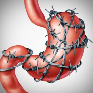What27sTheDifferenceBetweenIrritableBowelSyndromeandInflammatoryBowelDisease