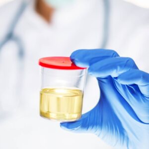 WhatTheColorOfYourUrineCanTellYouAboutYourHealth